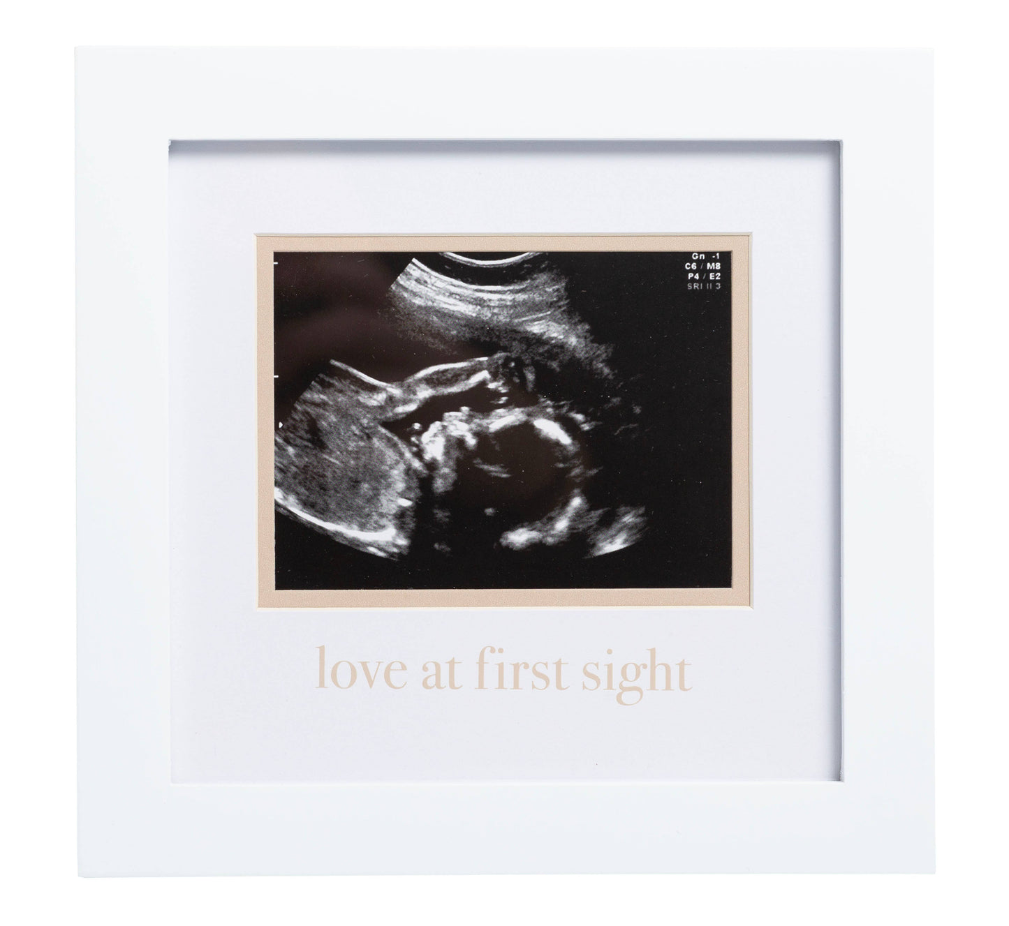 Love At First Sight Sonogram Picture Frame